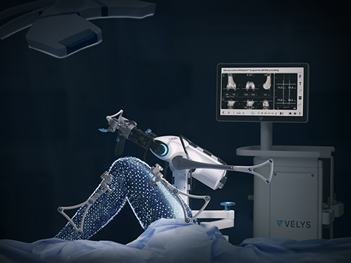 Johnson & Johnson VELYS Robotic-Assisted Solution